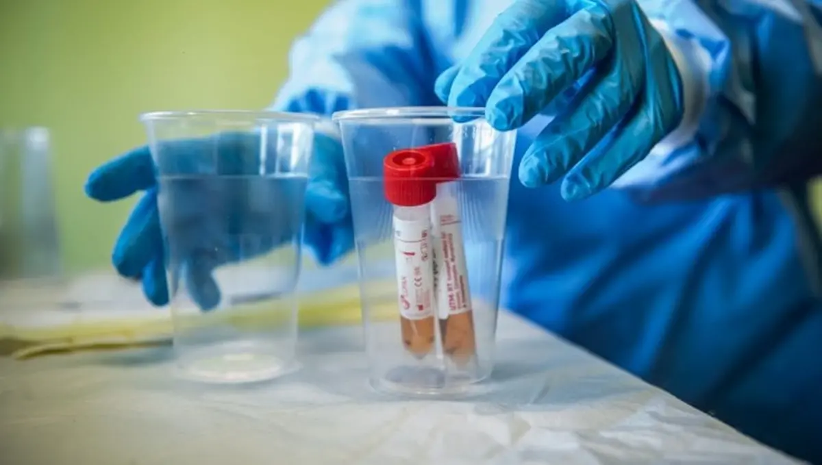Coronavirus Reggio Calabria, 162 nuovi casi nelle ultime 24 ore