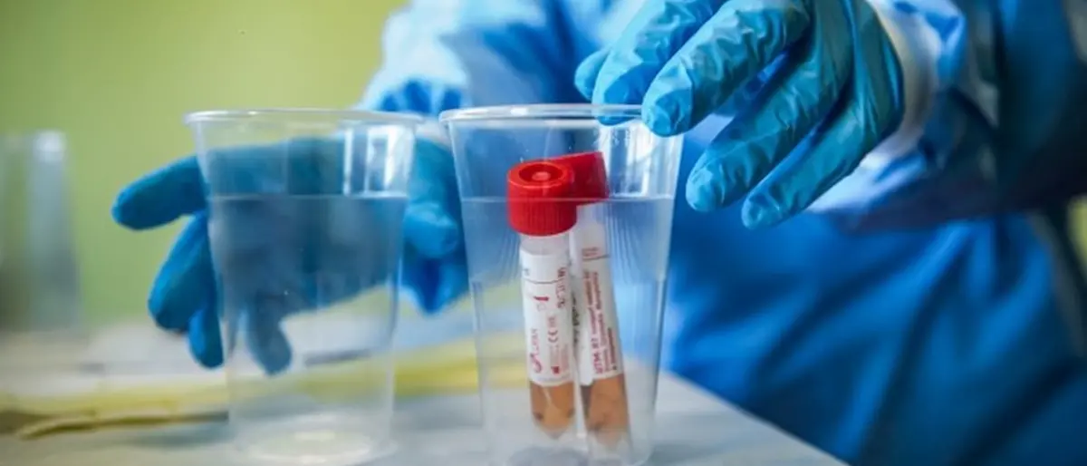 Coronavirus Reggio Calabria, 162 nuovi casi nelle ultime 24 ore