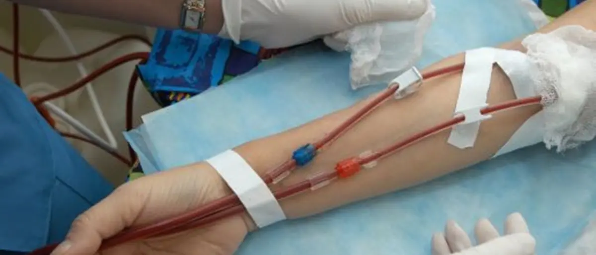 Aned Calabria: «Ripresa dei trapianti di rene al Gom di Reggio, una speranza per i pazienti dializzati»