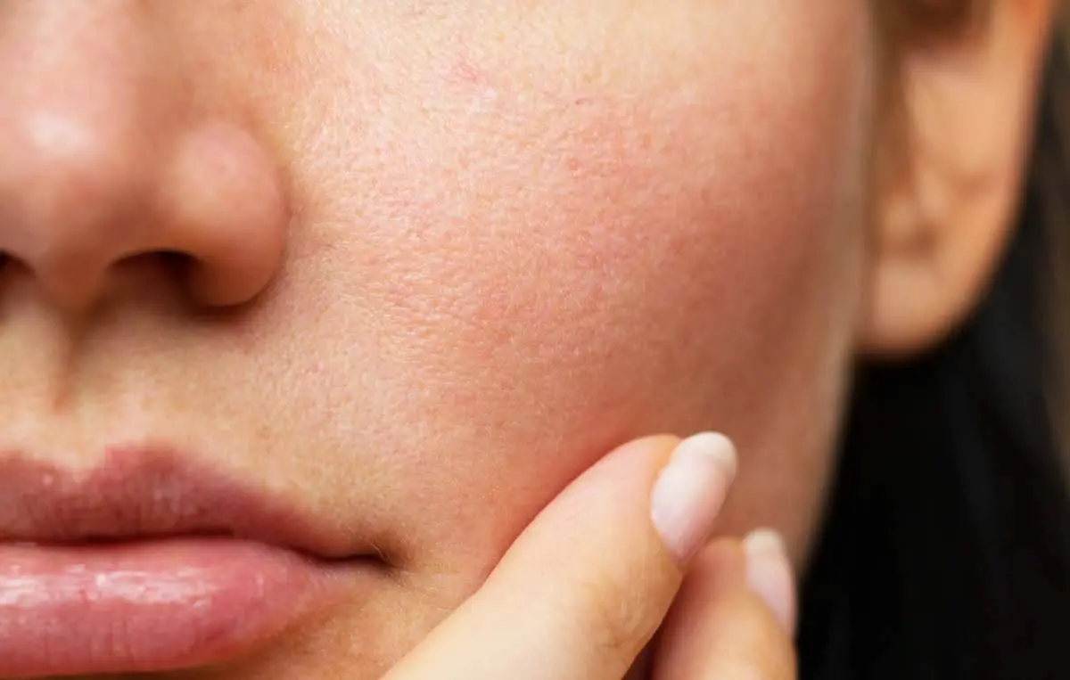 Roccella Jonica, successo per la tre giorni di \"Ygeia salute in piazza\"