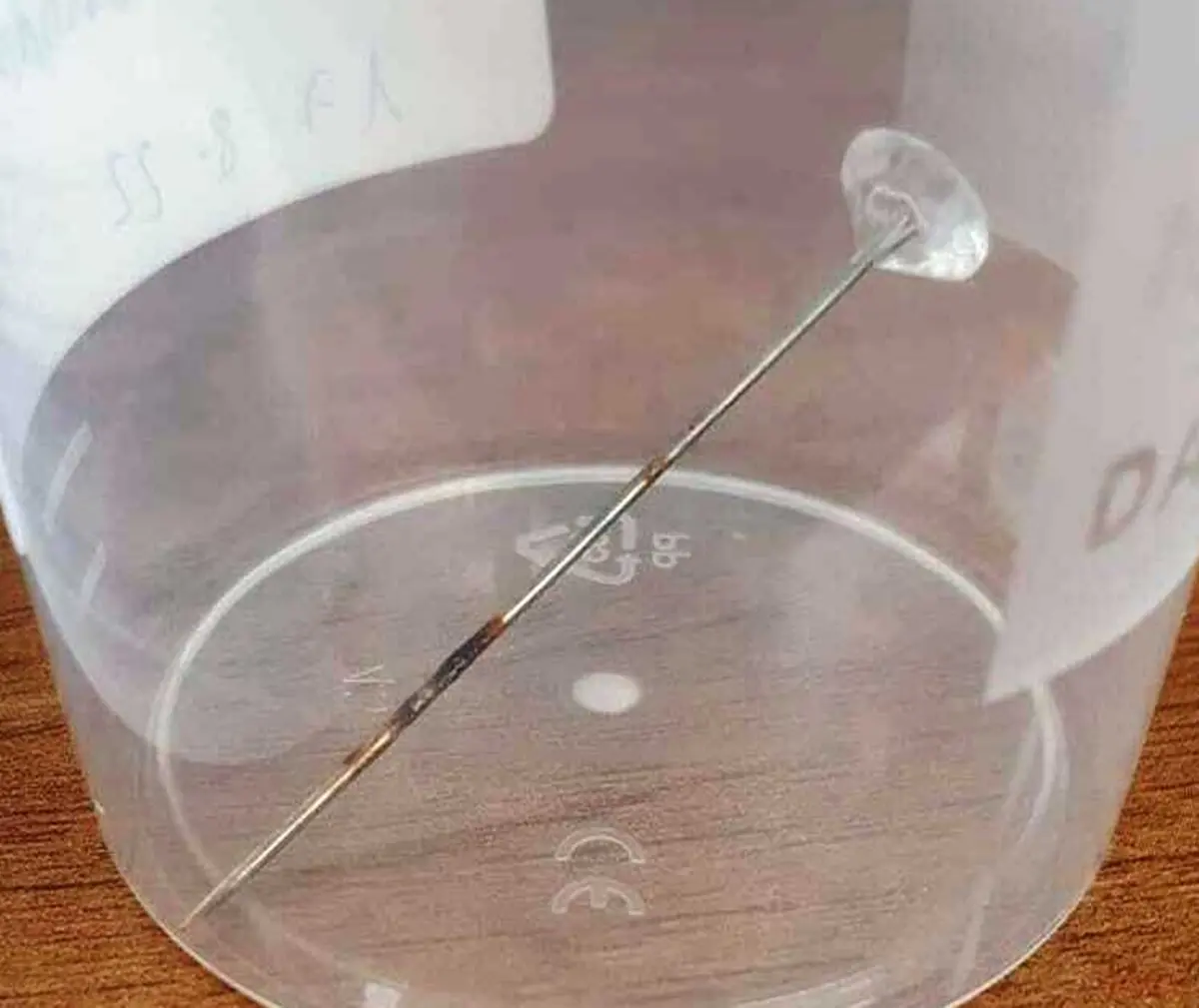 Gom di Reggio, soccorso d’urgenza bimbo che aveva inalato un ago