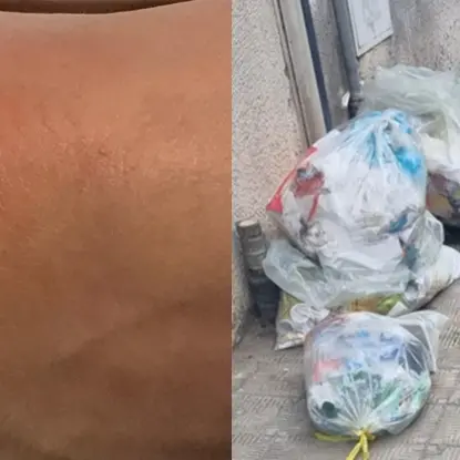 Reggio, costretta a saltare l'udienza per il morso di un topo nascosto tra i rifiuti del centro storico