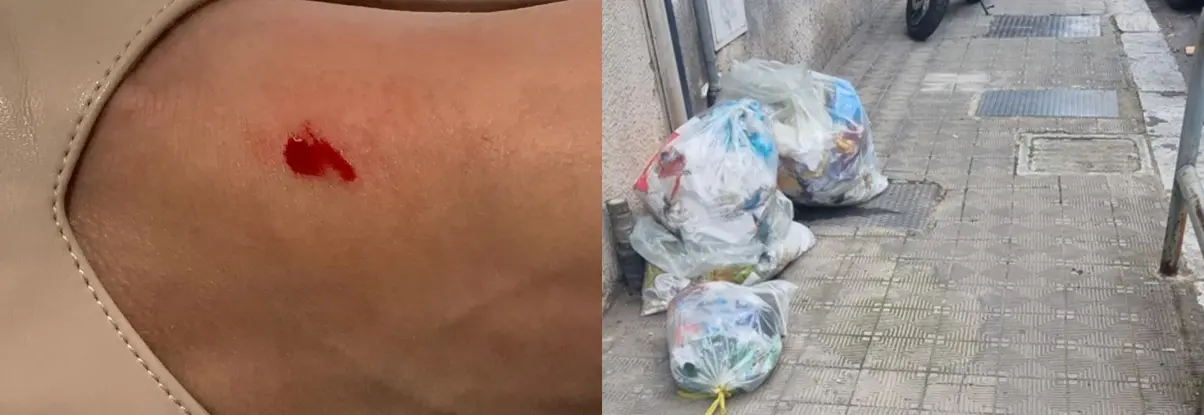 Reggio, costretta a saltare l'udienza per il morso di un topo nascosto tra i rifiuti del centro storico