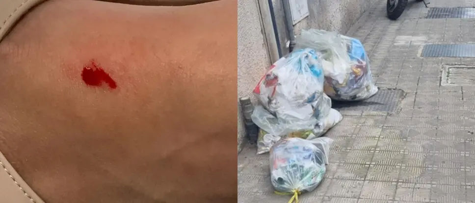 Reggio, costretta a saltare l'udienza per il morso di un topo nascosto tra i rifiuti del centro storico