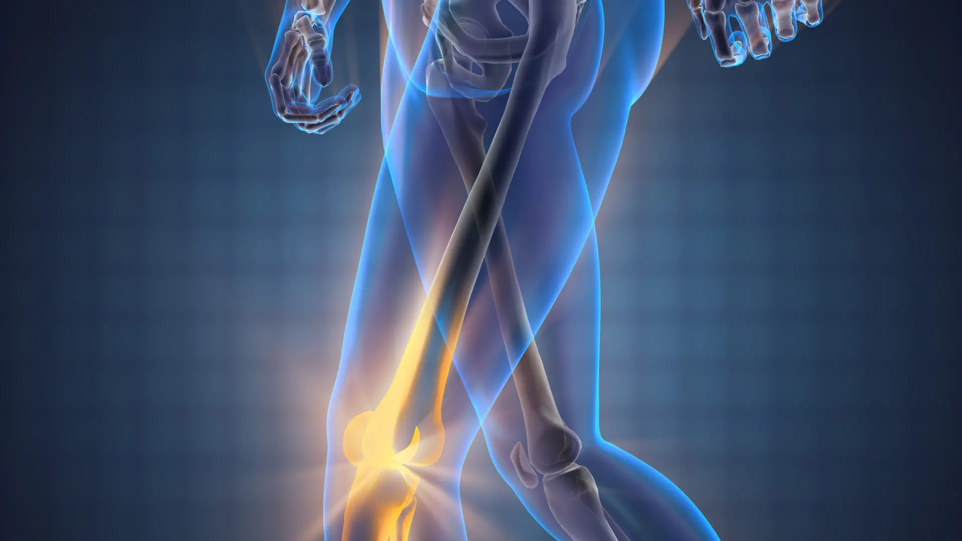 human bones radiography scan image , videodoctor - stock.adobe.com