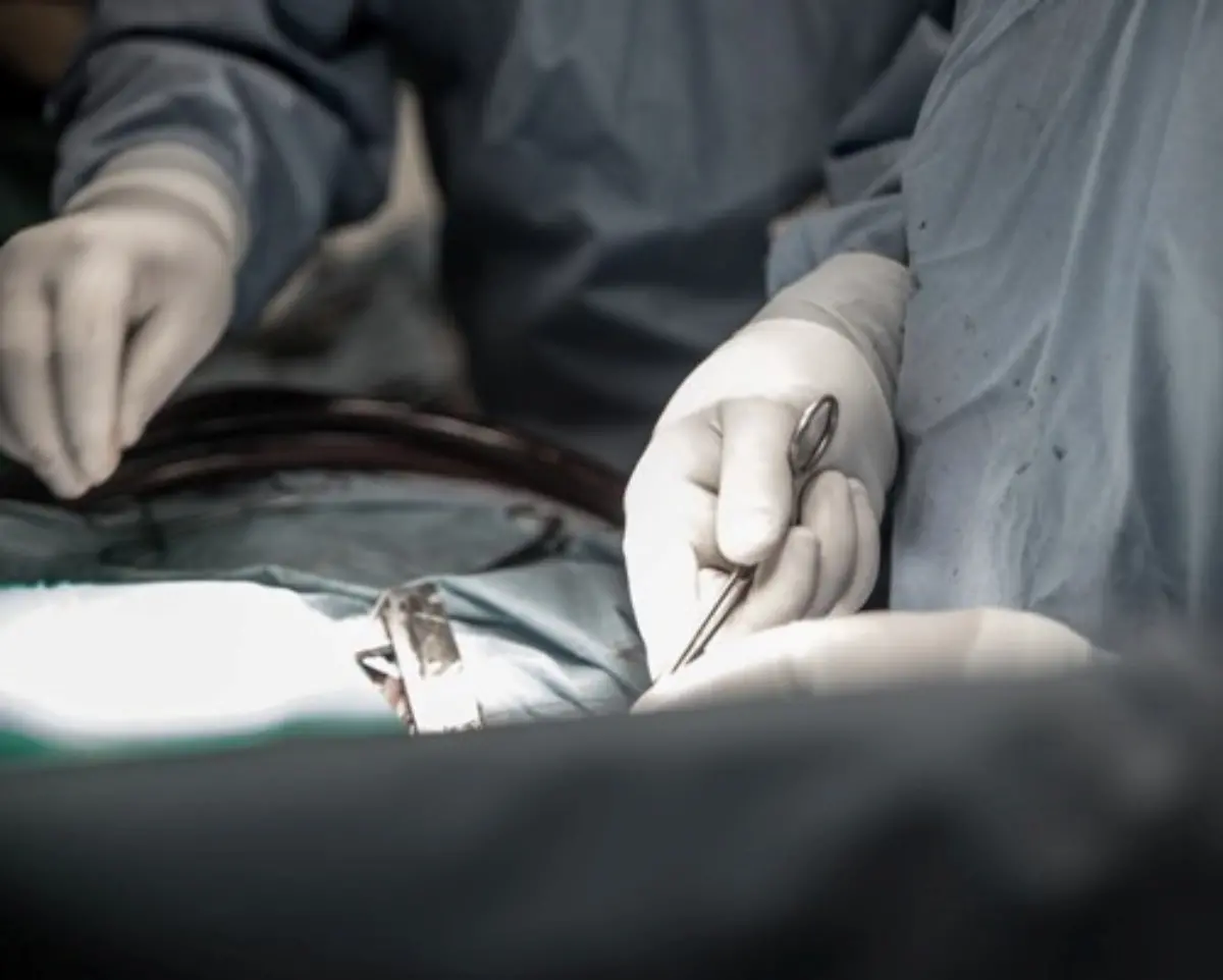 Gom di Reggio, ricostruito esofago cervicale con lembo di muscolo pettorale