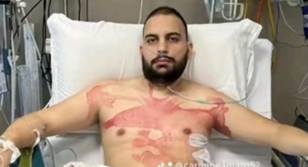 Malasanità, una polmonite non vista dai medici riduce in fin di vita un 27enne