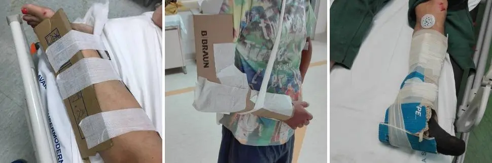 Gessi di cartone: furono sproporzionate le sanzioni a Caminiti, il medico che diffuse le foto dello scandalo al Gom