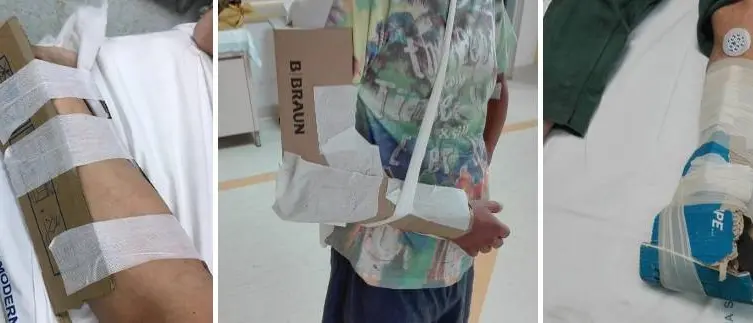 Gessi di cartone: furono sproporzionate le sanzioni a Caminiti, il medico che diffuse le foto dello scandalo al Gom