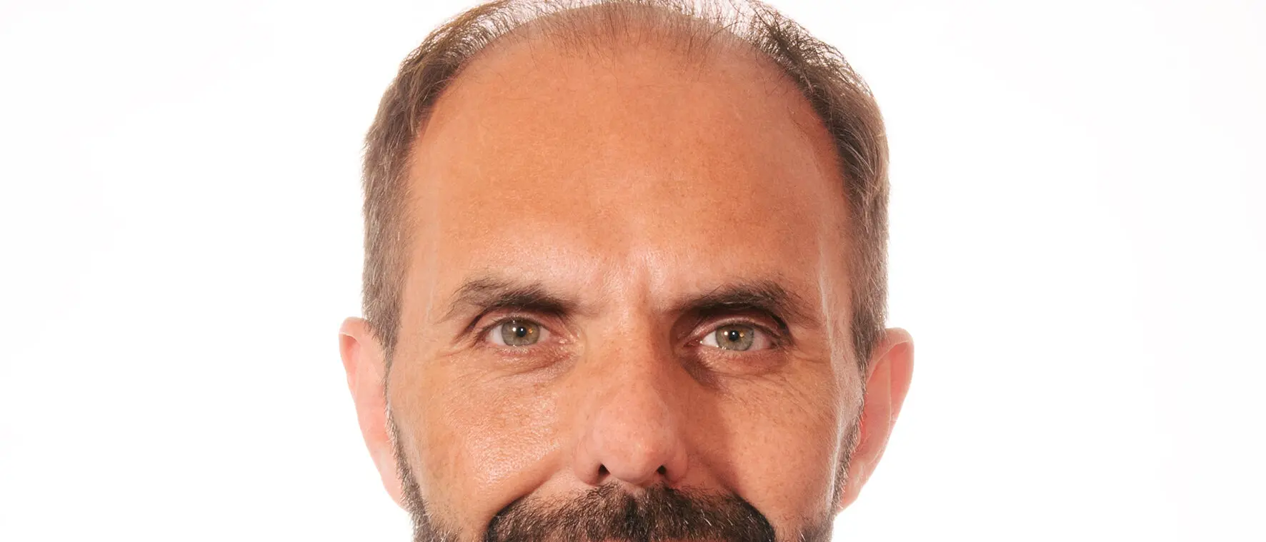 Antonino Musolino professionista reggino è il direttore della struttura complessa di Oncologia per lo Studio dei Tumori “Dino Amadori”