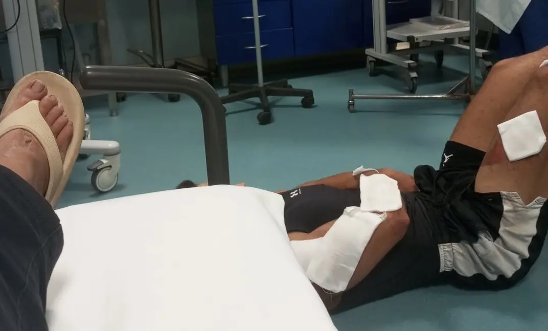 Ospedale di Locri, mancano barelle al Pronto Soccorso: pazienti adagiati a terra