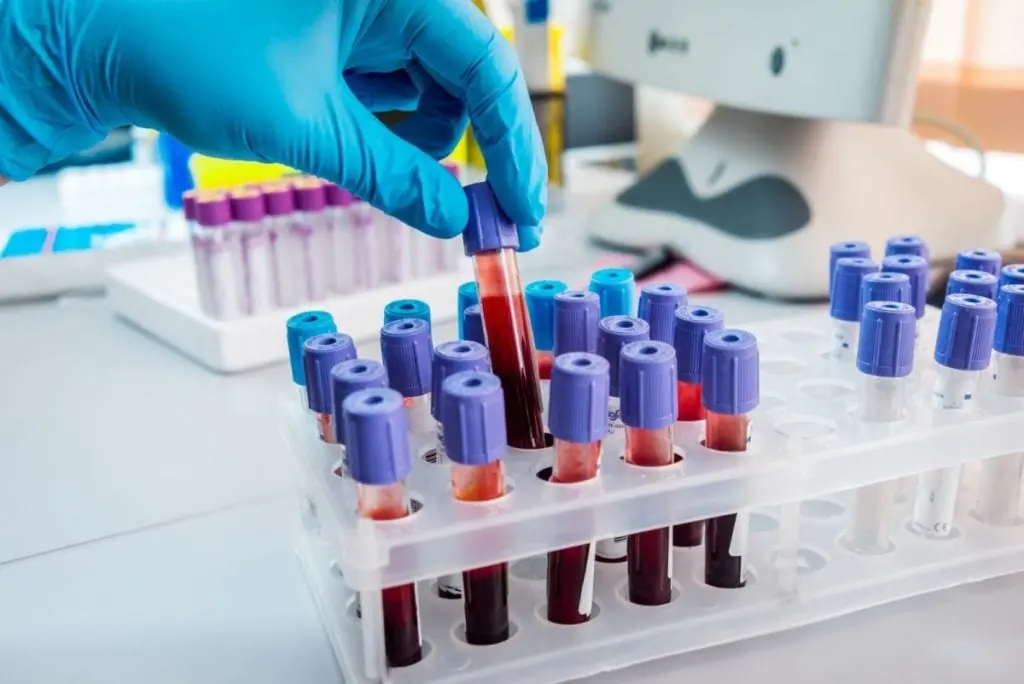 Coronavirus a Reggio Calabria, la conferma dell'Asp: nessun nuovo caso
