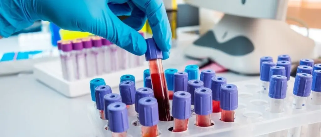 Coronavirus a Reggio Calabria, la conferma dell'Asp: nessun nuovo caso