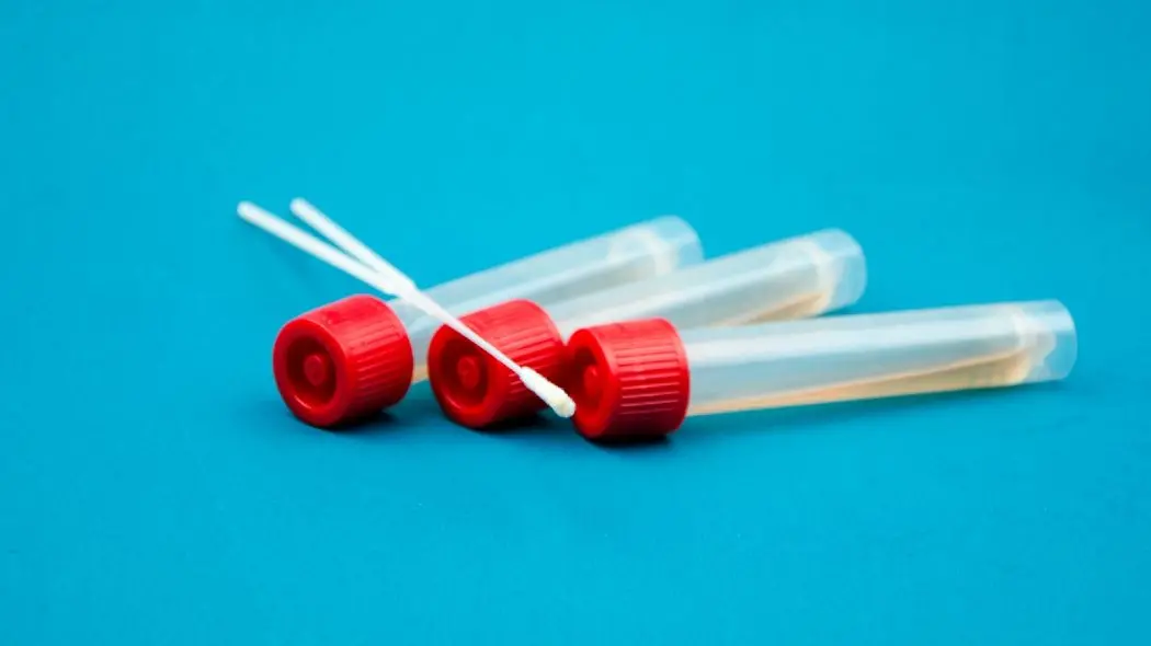 Coronavirus nella Locride, nuovo caso positivo a Siderno