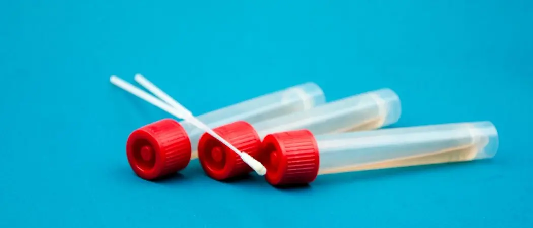 Coronavirus nella Locride, nuovo caso positivo a Siderno