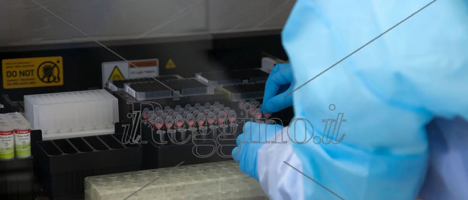 Coronavirus a Reggio Calabria, due nuovi casi positivi in un giorno. Il bollettino della Regione