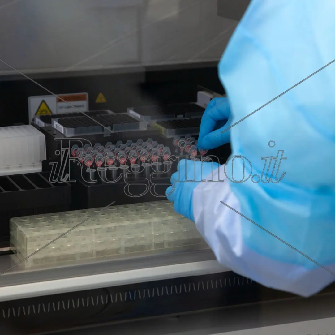 Coronavirus a Reggio Calabria, ieri un caso positivo. Il bollettino dell'Asp