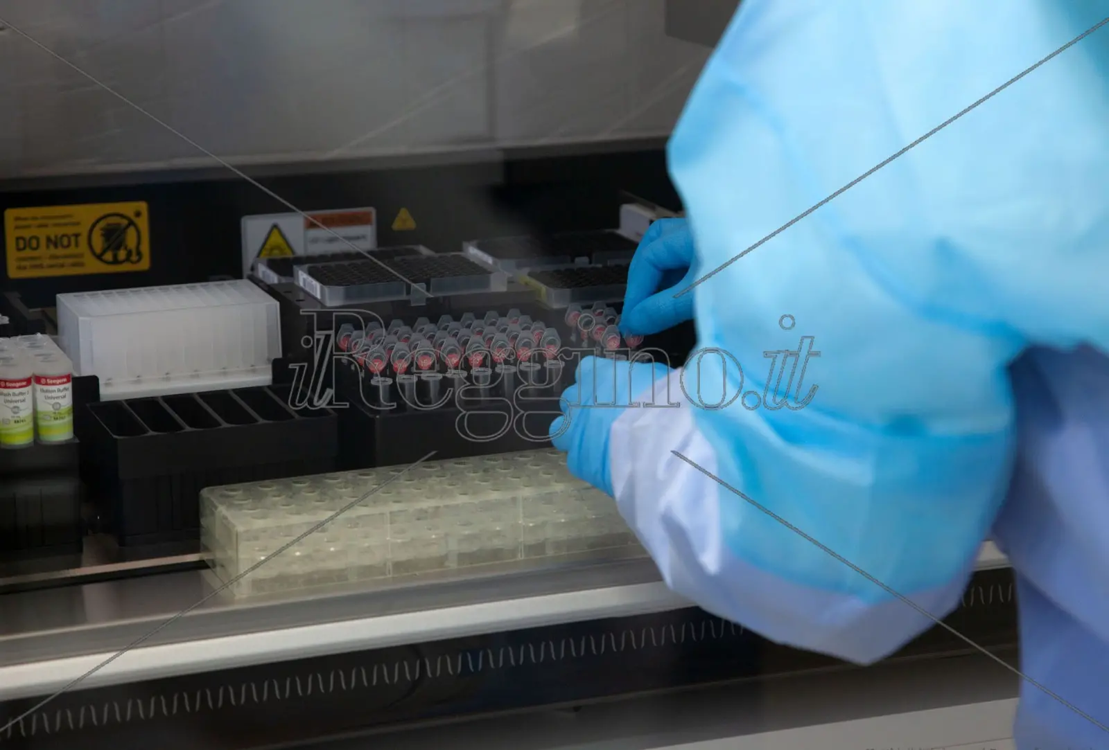 Coronavirus a Reggio Calabria, ieri un nuovo caso positivo. Il bollettino dell'Asp