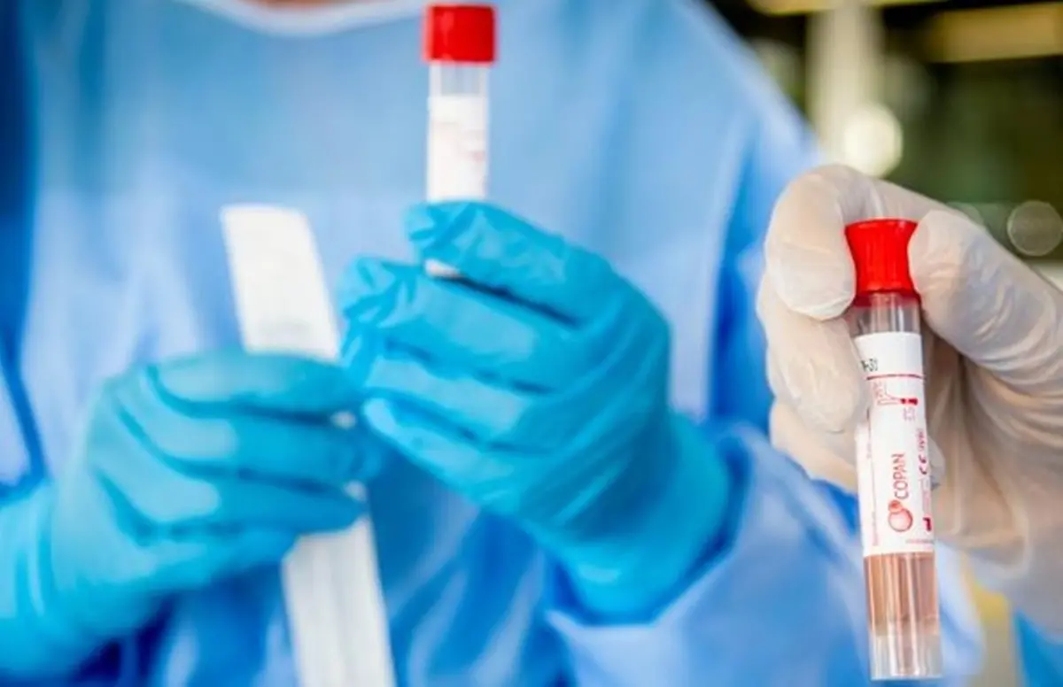 Coronavirus Reggio Calabria, 2 morti e 43 nuovi casi. Il bollettino regionale