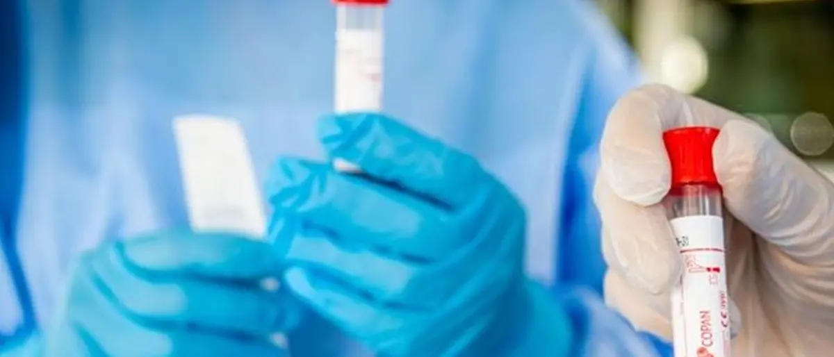 Coronavirus Reggio Calabria, 2 morti e 43 nuovi casi. Il bollettino regionale