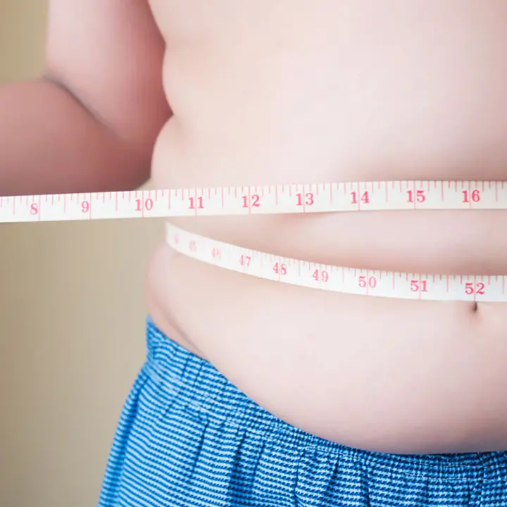 Obesità riconosciuta come malattia, Abenavoli: «Chi ne soffre non è colpevole, ma ha diritto a cure e rispetto»\n
