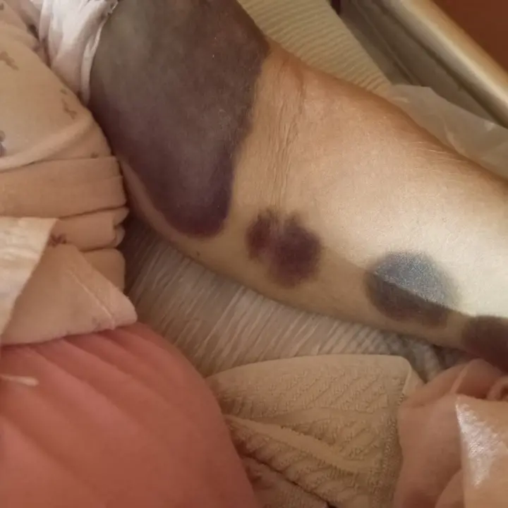 Pronto Soccorso di Cosenza shock, il grido di una figlia: «Così hanno ridotto mia madre»