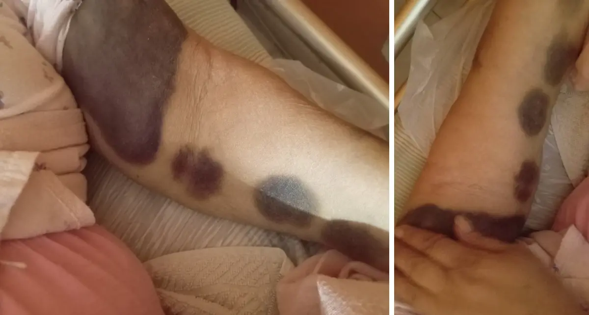 Pronto Soccorso di Cosenza shock, il grido di una figlia: «Così hanno ridotto mia madre»