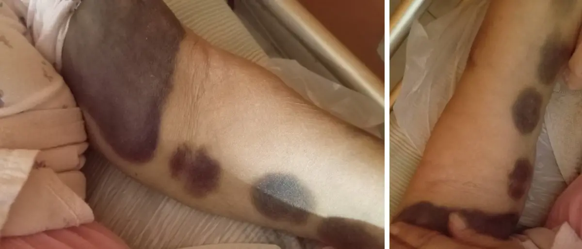 Pronto Soccorso di Cosenza shock, il grido di una figlia: «Così hanno ridotto mia madre»