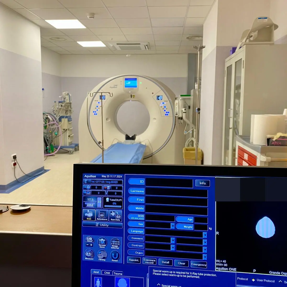 Compie un anno il nuovo reparto di Neuroradiologia del GOM di Reggio