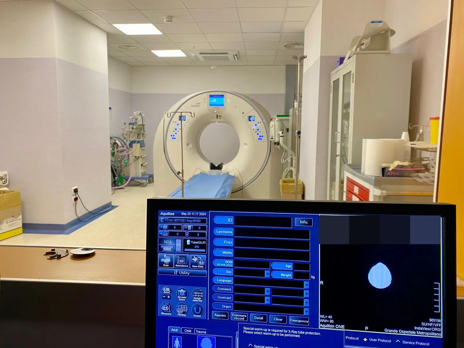 Compie un anno il nuovo reparto di Neuroradiologia del GOM di Reggio