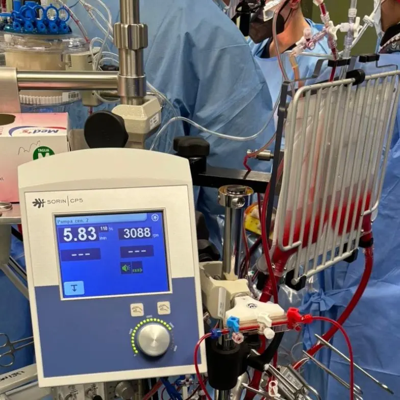 La Cardiochirurgia Dulbecco di Catanzaro adotta\u00A0il programma “mini-circolazione extracorporea”: è l’unico del sud Italia\n