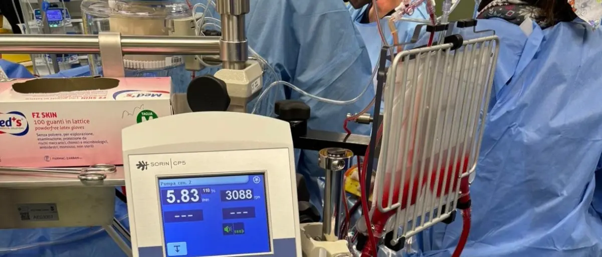 La Cardiochirurgia Dulbecco di Catanzaro adotta\u00A0il programma “mini-circolazione extracorporea”: è l’unico del sud Italia\n