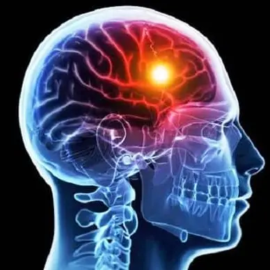 Giornata della Fisioterapia, a Cosenza screening gratuiti per prevenire ictus e malattie cardiovascolari\n