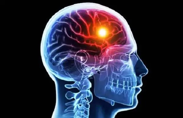 Ictus, da venerdì XXI Congresso nazionale SISS a Gizzeria