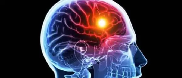 Ictus, da venerdì XXI Congresso nazionale SISS a Gizzeria