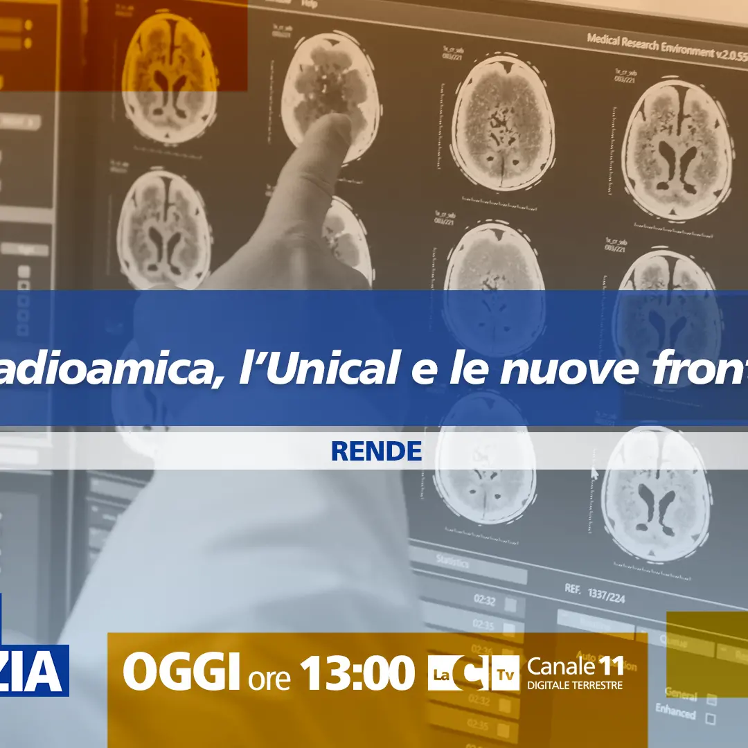 La radiomica, l’Unical e le nuove frontiere della medicina al centro della nuova puntata di Dentro la notizia\n