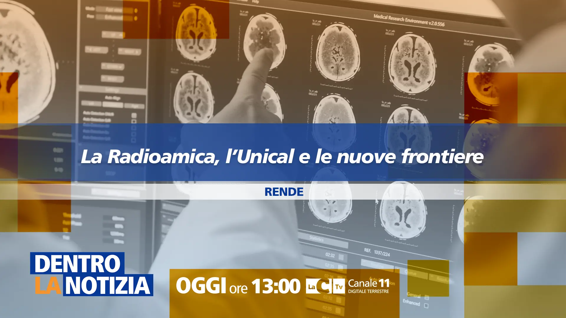 La radiomica, l’Unical e le nuove frontiere della medicina al centro della nuova puntata di Dentro la notizia\n