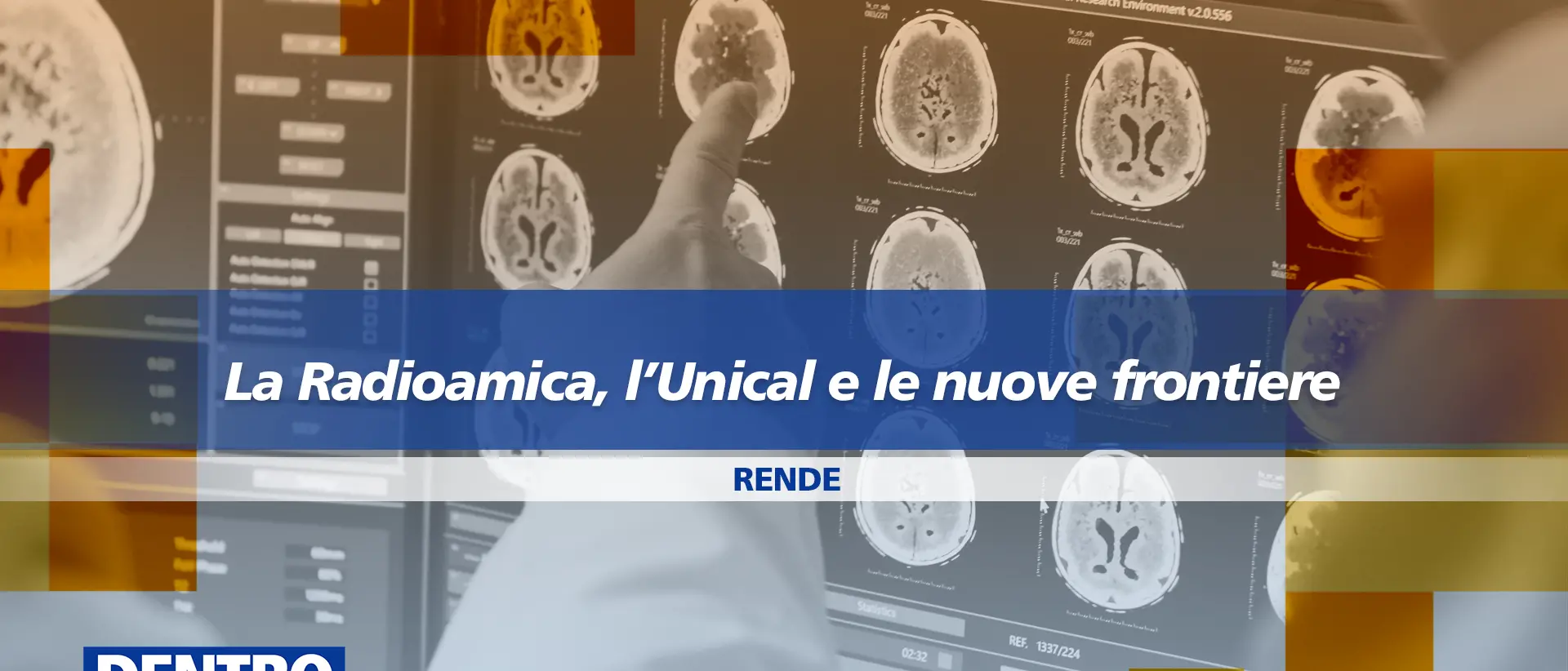 La radiomica, l’Unical e le nuove frontiere della medicina al centro della nuova puntata di Dentro la notizia\n