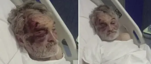 Aggressione al clochard Cristian, i cani sono al sicuro. E si pensa ad una raccolta fondi