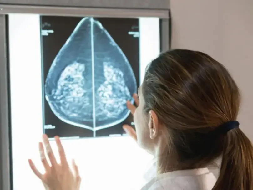 Tumori, nel 2025 in Italia 390mila casi: calano i morti, fuga dalla Calabria per curare il cancro al seno