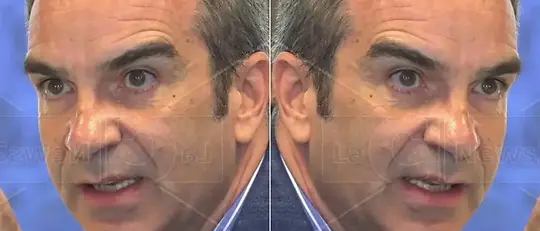 I due Roberto Occhiuto: a Roma fa il rivoluzionario, a Catanzaro si veste da conservatore (e conferma i manager)\n