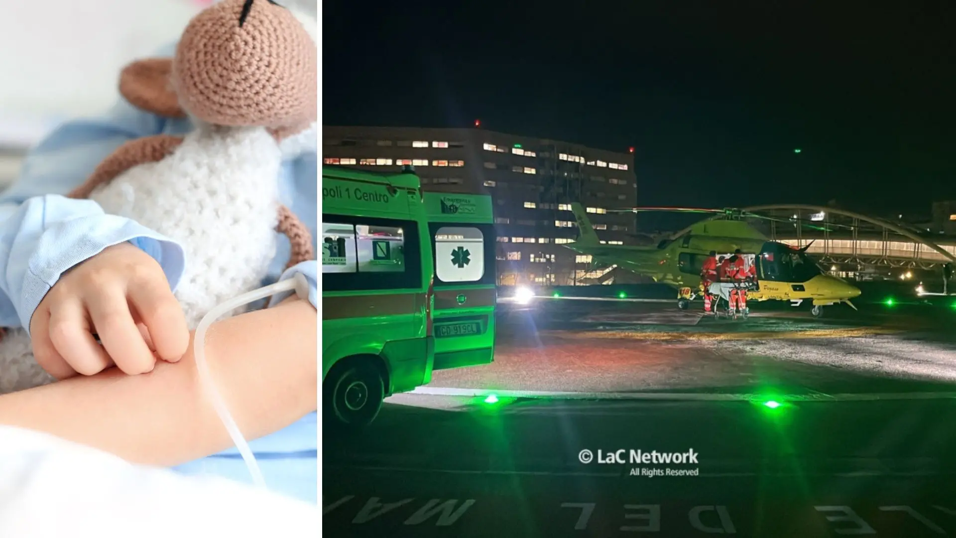 Bimbo di Catanzaro ustionato dal brodo bollente, stabili le condizioni: è ancora ricoverato a Napoli\n