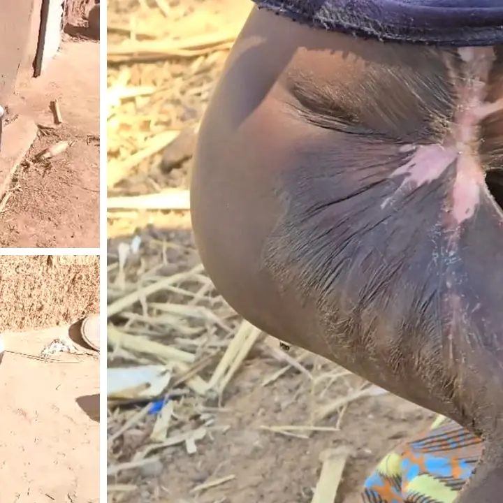 Dal Sahel al Ghana, la rinascita di Jamal: un bambino torna a camminare grazie alla forza della solidarietà\u00A0\n\n\n\n