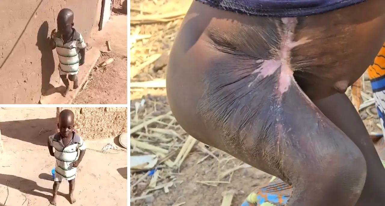 Dal Sahel al Ghana, la rinascita di Jamal: un bambino torna a camminare grazie alla forza della solidarietà\u00A0\n\n\n\n