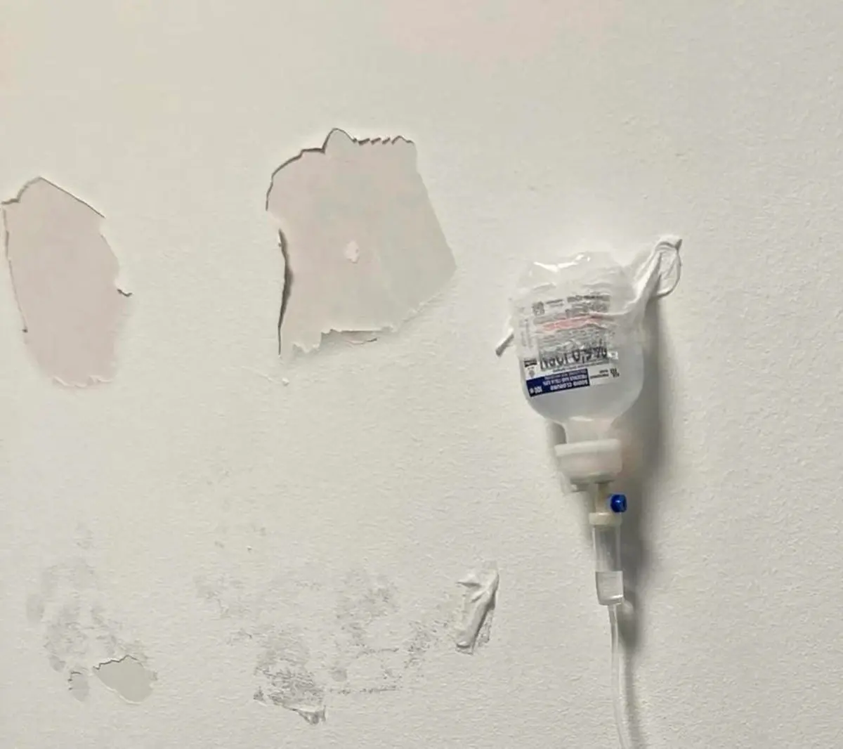 Due giorni in Pronto Soccorso in attesa di ricovero con la flebo attaccata al muro con un cerotto: la testimonianza che premia il personale e boccia le carenze\u00A0strutturali\n