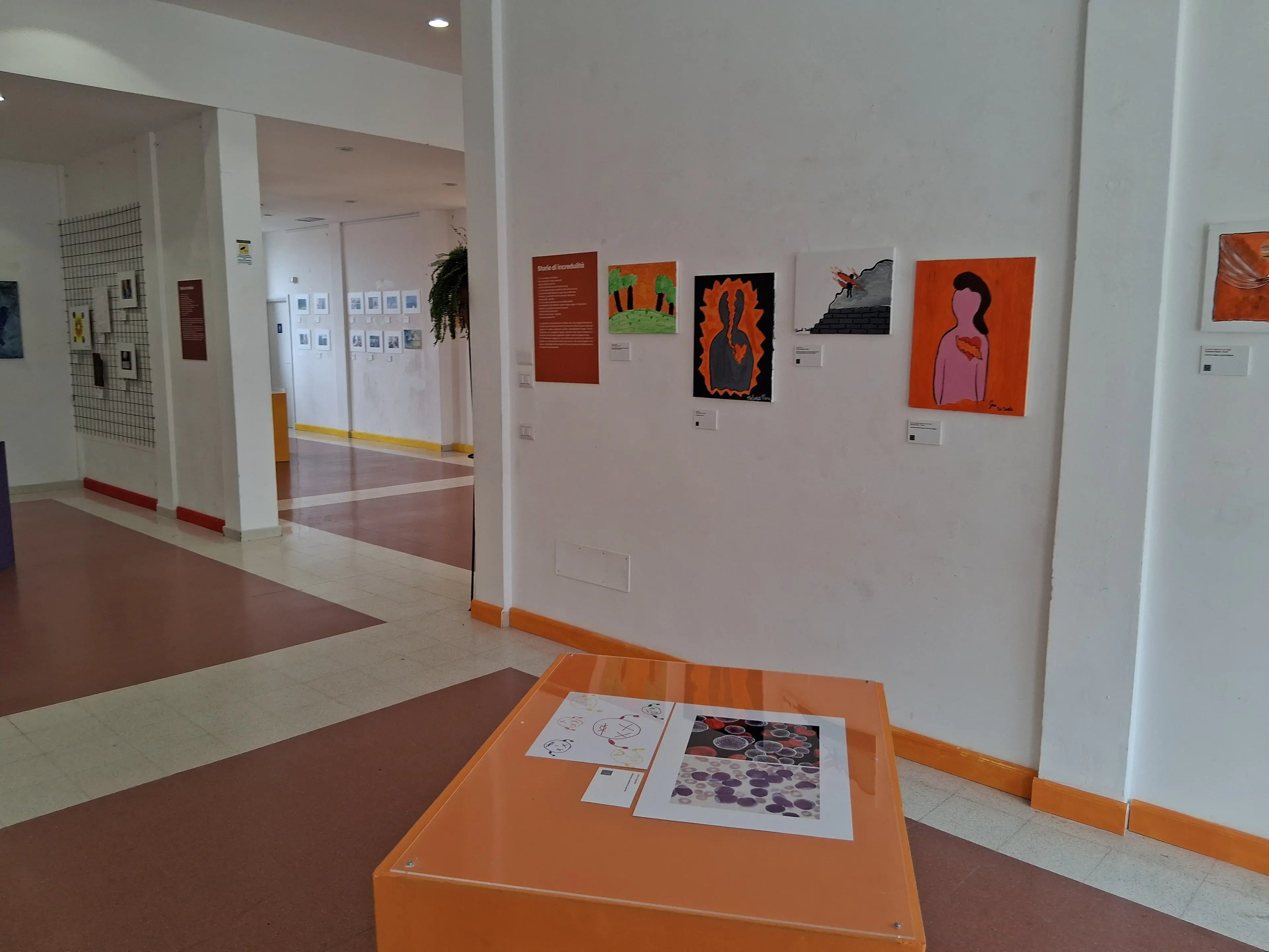 Oltre la diagnosi: in mostra a Catanzaro la “stra-ordinaria normalità” dei piccoli pazienti della Dulbecco\u00A0\n