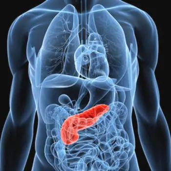 Eliminato per la prima volta in laboratorio il tumore al pancreas in stadio avanzato. I risultati della ricerca\n