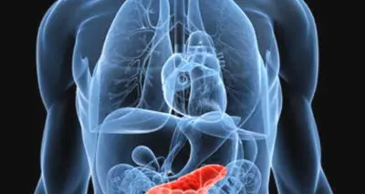 Eliminato per la prima volta in laboratorio il tumore al pancreas in stadio avanzato. I risultati della ricerca\n