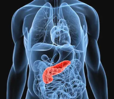 Eliminato per la prima volta in laboratorio il tumore al pancreas in stadio avanzato. I risultati della ricerca\n