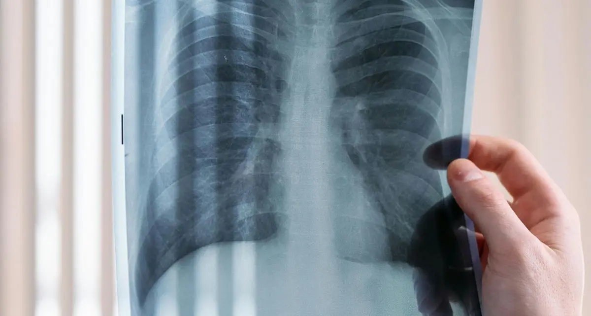 Amianto in Calabria, 600 casi di mesotelioma dal 1993: il pericolo dei 15 milioni di metri quadrati di tetti in eternit\n